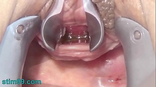 Мастурбирайте дупка с четка за зъби и верига в уретрата