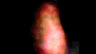 Weeing On An Achy Bladder